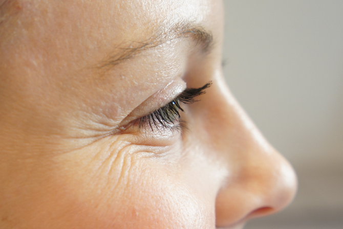 How Wrinkles Form & What You Can Do