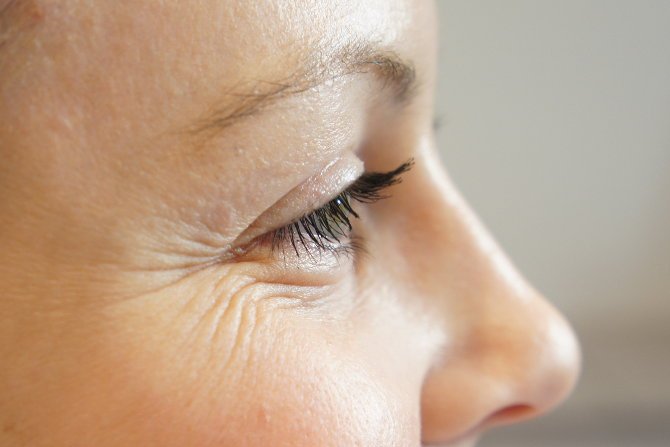 How Wrinkles Form & What You Can Do